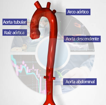 aorta instituto cardiotecnologico andaluz